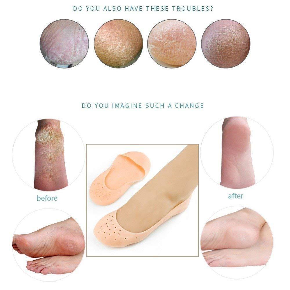 Anti Crack Silicone Gel Foot Protector Moisturizing Socks - Happy Price - Image 2