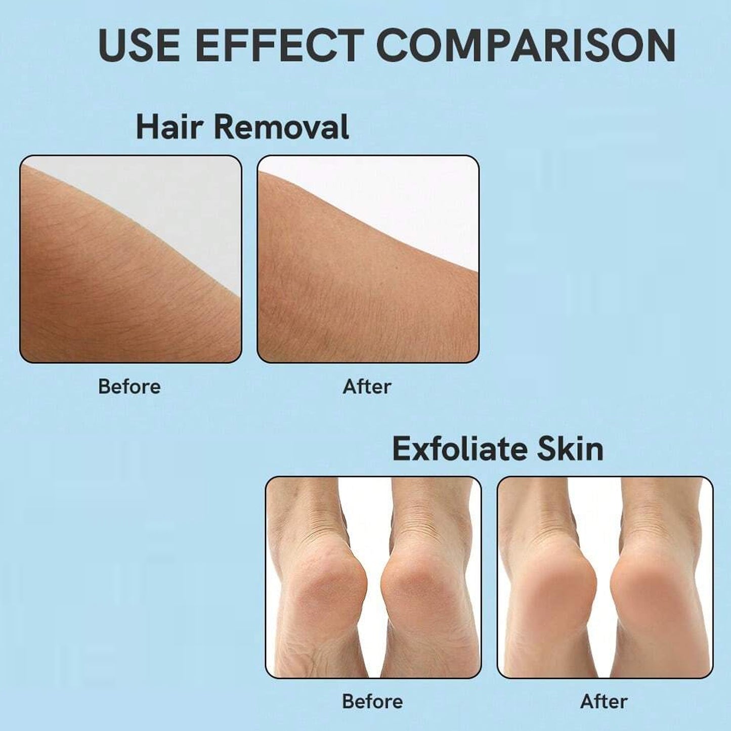 Nano Hair Remover For Arms Legs Back One Sided Skin Hair Remover (1 Pc) - Happy Price - Image 6