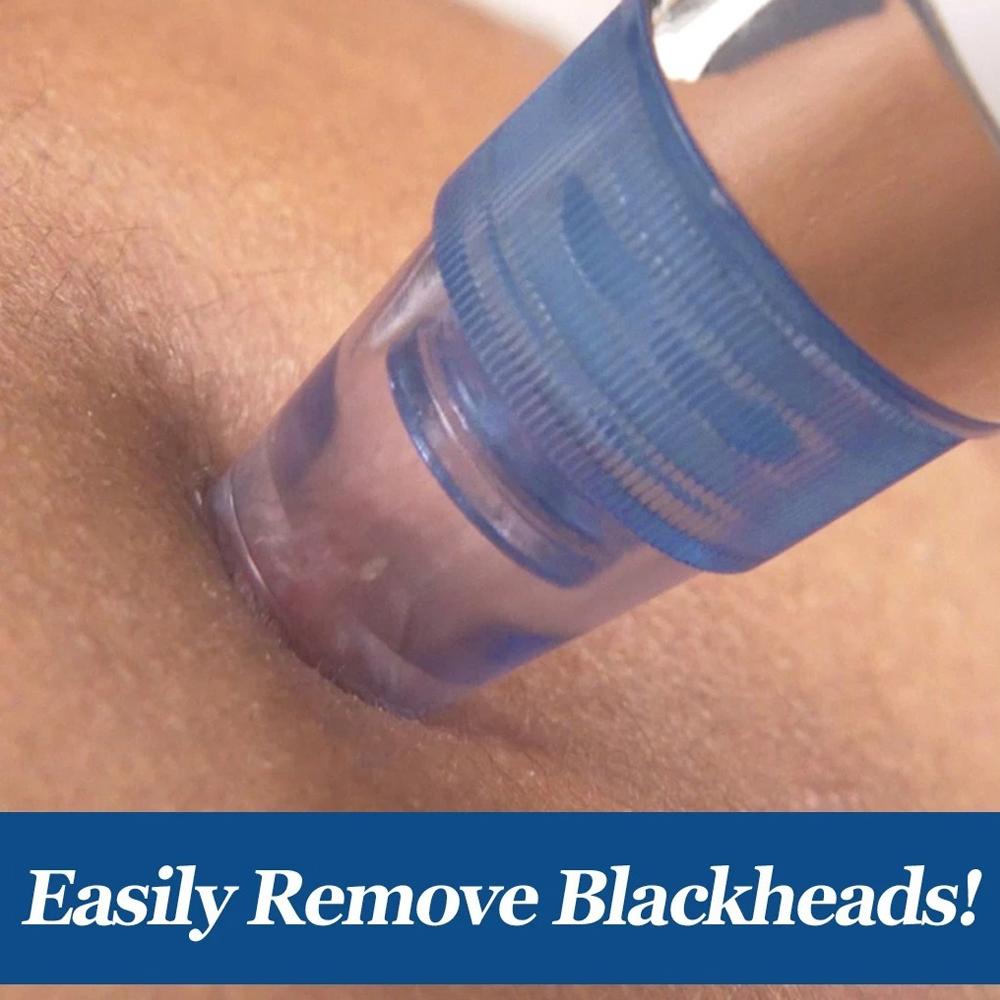4 In 1 Blackhead Whitehead Extractor Remover Device Acne Pimple Pore Cleaner (Vacuum Suction Tool) - Happy Price - Image 3