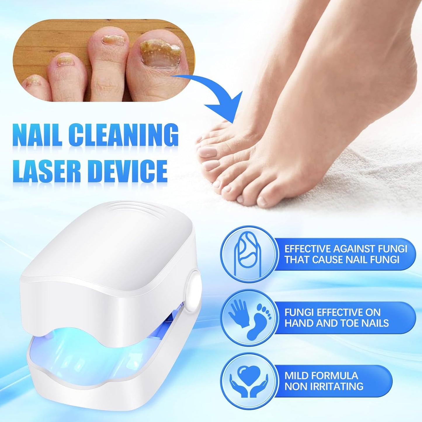 Rechargeable Nail Fungus Treatment For Toenail Toe Nail Fungal Treatment Nail Fungus Laser Device Anti-fungal Nail Treatment For Hand  Feet Infections Remover For Home Use - Happy Price - Image 2