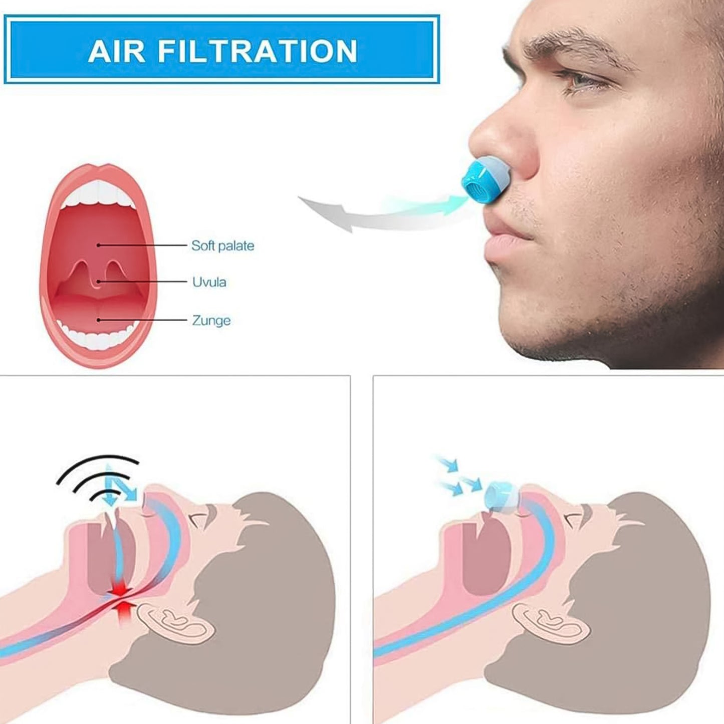 2 In 1 Anti Snoring And Air Purifier Nose Clip Anti Snoring Device (1 Pc  With Plastic Case) - Happy Price - Image 2