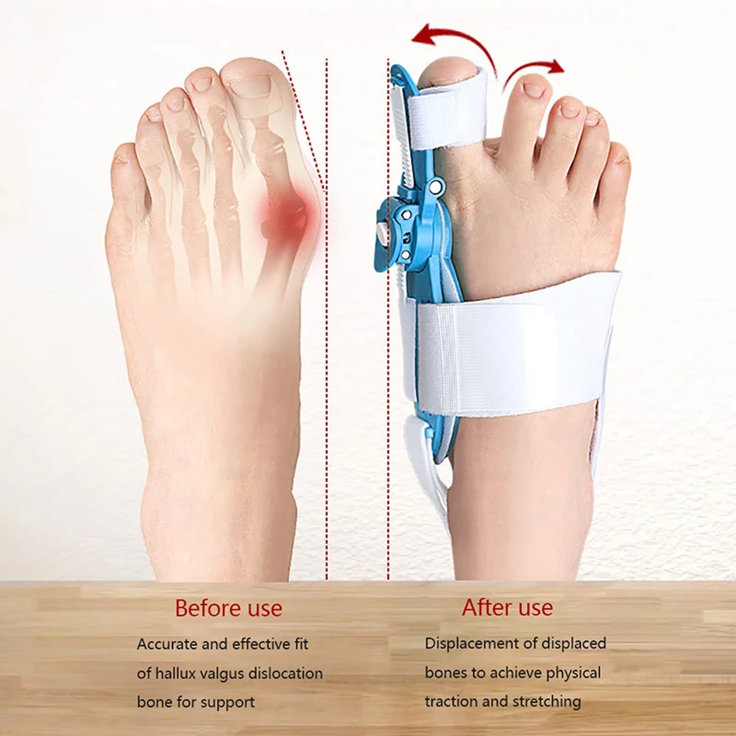 Bunion Support Splint. Valgus And Bunion Valgus Corrector Hallux Valgus Corrector Adjustable Bunion Valgus Protective Cover For Men And Women - Happy Price - Image 4
